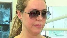 Renata Banhara aparece com rosto paralisado em 1ª entrevista pós-cirurgias