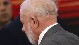 Presidente Lula passará por novo procedimento médico nesta quinta-feira (12)