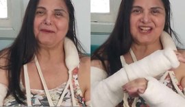 Atriz Elizangela sofre acidente doméstico e quebra os dois braços