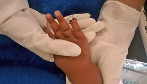 Bebê internada por picada na testa tem parte do dedo amputada após corte na hora de tirar atadura
