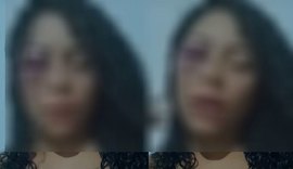 Ex-namorado que agrediu dançarina é liberado após audiência de custódia