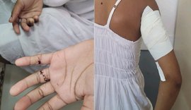 Polícia Civil autua homem por estupro e tentativa de homicídio em Maragogi