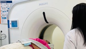 Hospital da Mulher realiza 6.740 exames de tomografia computadorizada em oito meses