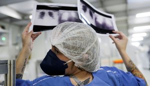 Alagoas registra 436 novos casos de Covid-19 e mais uma morte neste domingo (9)