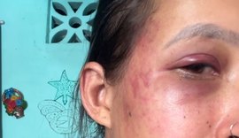Mulher usa redes sociais para denunciar violência doméstica cometida pelo companheiro