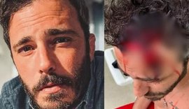 Thiago Rodrigues é espancado por bandidos no Rio de Janeiro e encontrado desacordado na rua