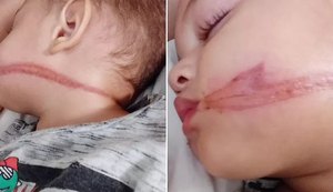 Bebês gêmeos de 1 ano e 6 meses são atingidos por fios soltos em São Paulo