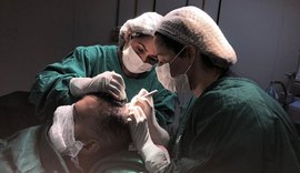 Transplante capilar ganha força em AL com sistema desenvolvido por Hospital Veredas