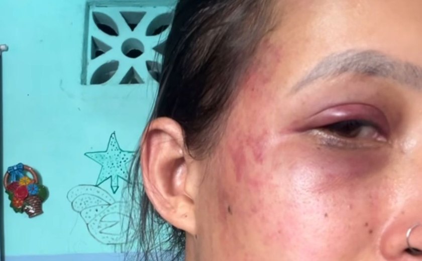 Mulher usa redes sociais para denunciar violência doméstica cometida pelo companheiro