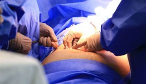Covid-19 vitimou mais crianças do que adolescentes em Alagoas