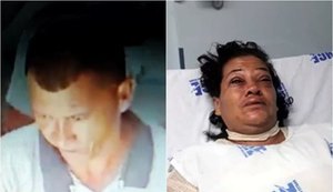 Justiça decreta prisão de acusado de jogar ácido em ex-companheira