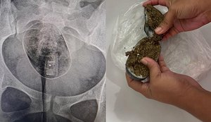 Mulher é flagrada ao tentar entrar em presídio com drogas e vai parar no HGE