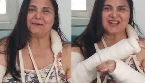 Atriz Elizangela sofre acidente doméstico e quebra os dois braços