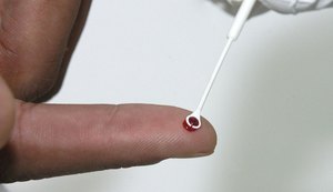 HIV: estudo mostra resistência de mutação a remédio usado no Brasil