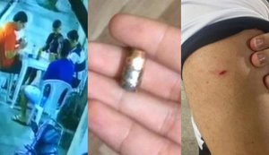 Ex-dirigente do ASA é atingido por bala perdida em lanchonete de Arapiraca