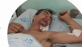 Homem que perdeu perna em acidente de moto precisa de doação de sangue e alimentos para família