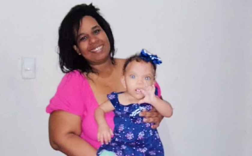 Mãe de bebê com síndrome rara faz campanha para comprar aparelho auditivo