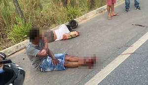 Acidente deixa motociclista com parte da perna amputada na BR-104