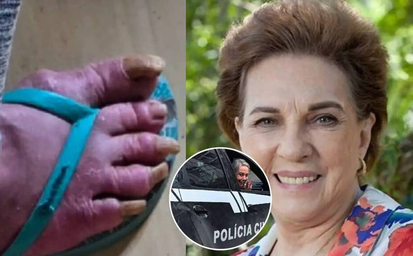 Quem é a famosa atriz da TV Globo encontrada em situação de abandono em Porto Alegre
