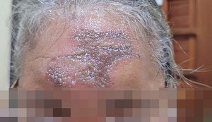 Após receberem ''óleo da graça'' durante missa, fiéis procuram paróquia com ferimentos na testa