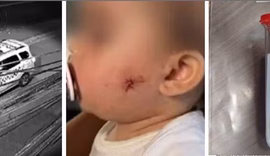 Justiça militar torna réu por lesão corporal PM acusado de dar tiro no rosto de bebê com arma de airsoft
