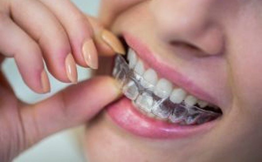 Sorrir virou tendência: mercado de ortodontia estética vive seu melhor momento