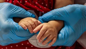 SUS passa a oferecer tratamento inovador de atrofia muscular espinhal