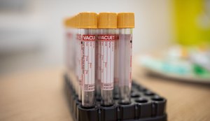 Alagoas registra 194 novos casos e seis mortes de Covid-19 nas últimas 24 horas