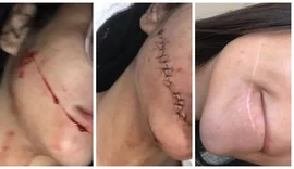 Suspeita de cortar rosto de jovem durante viagem de ônibus na BA é presa em São Paulo