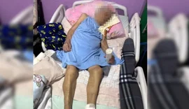 Enfermeira amputa pé de idosa de 103 anos com bisturi cego e sem anestesia