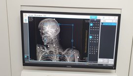 IML de Maceió começa a operar novo software para exames com scanner corporal
