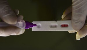 Pesquisadores identificam método capaz de prever gravidade da Covid-19