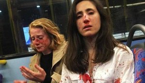 Casal de lésbicas é atacado por grupo de homens em ônibus
