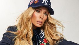 Adriane Galisteu é diagnosticada com síndrome do piriforme