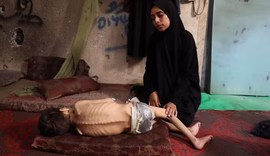 Falta de alimentos, desnutrição grave e mortalidade elevada: fome em Gaza atinge fase 5, o pior em escala de órgão ligado a ONU; entenda