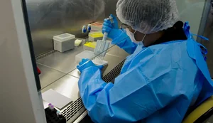 Novo teste de HPV no SUS pode antecipar diagnóstico em até 10 anos