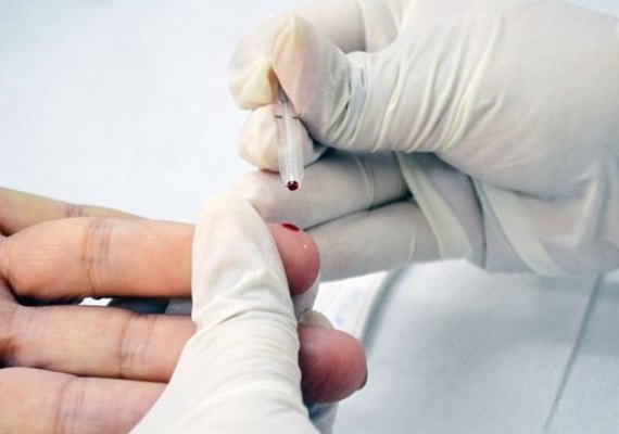 Unidades de saúde contam com diagnóstico e tratamento para sífilis
