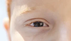 Erros de refração são principal causa de deficiência visual infantil