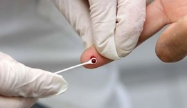 Número de mortes por aids diminuiu 12% na América Latina desde 2000