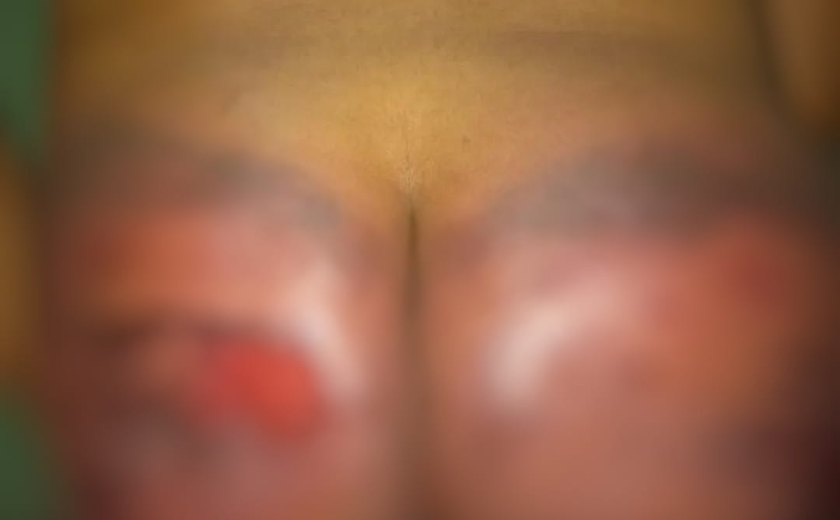 PC vai investigar suposta agressão a jovem em São José da Laje