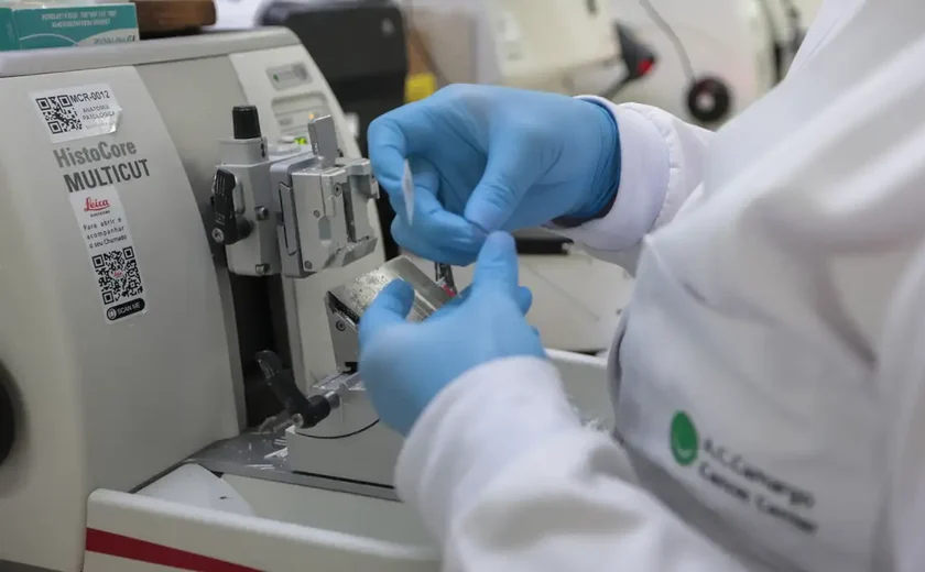 Cura de câncer de próstata pode chegar a até 98%