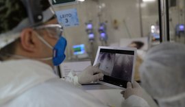 Brasil tem 32.572 novos casos de Covid-19 e 1.305 mortes nas últimas 24 horas