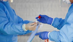 Alagoas volta a registrar mais de 500 casos de Covid-19 em um dia, além de cinco mortes