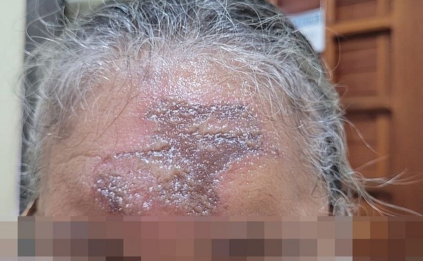 Após receberem ''óleo da graça'' durante missa, fiéis procuram paróquia com ferimentos na testa