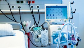 Polícia Federal faz operação e apura fraude em compra de respiradores pulmonares