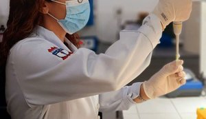 Pesquisadores estudam relação entre microbiota intestinal e a epilepsia