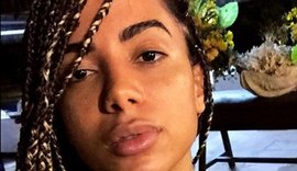 Visual de Anitta divide opiniões na web e fãs questionam: 'Por que não pode?