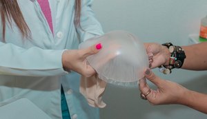 Saúde oferta prótese mamária externa a mulheres mastectomizadas