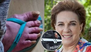 Quem é a famosa atriz da TV Globo encontrada em situação de abandono em Porto Alegre