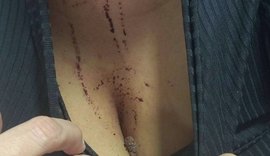 Homem é autuado por lesão corporal dolosa e ameaça contra ex-companheira